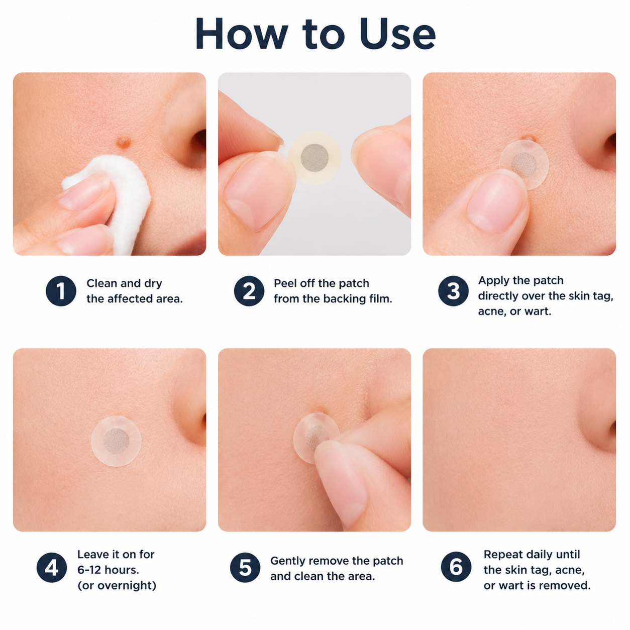 🏥𝐏𝐮𝐫𝐞𝐥𝐨𝐫𝐚®2-in-1 Microneedle & Hydrocolloid Patch🍀| Removes Raised Moles, Acne, Flat Warts & Skin Tags | Helps Improve Wrinkles, Scars & Blemishes | Invisible Patches for Face & Body