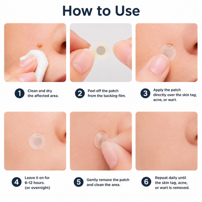 🏥𝐏𝐮𝐫𝐞𝐥𝐨𝐫𝐚®2-in-1 Microneedle & Hydrocolloid Patch🍀| Removes Raised Moles, Acne, Flat Warts & Skin Tags | Helps Improve Wrinkles, Scars & Blemishes | Invisible Patches for Face & Body