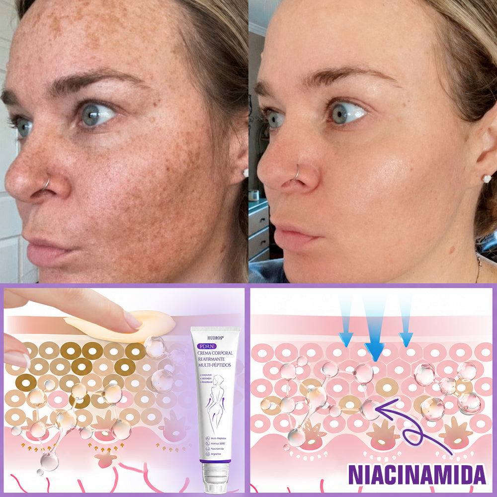 Funcionario de la FDA recomienda Hudros® PDRN: crema corporal con rodillo para antienvejecimiento, hidratación, reafirmación, lifting y reparación de la piel.También ayuda a mejorar manchas oscuras, acné, verrugas, lunares y síntomas de psoriasis.