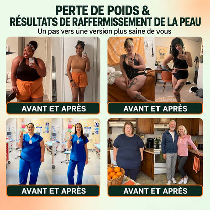 🔥 DERNIER JOUR : -80% | Semelles en Graphène Amincissantes | Soutien Minceur & Confort des Pieds