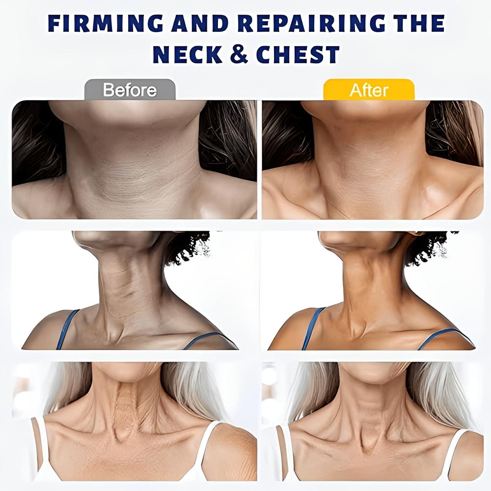 🎉 Purelora® Instant Neck Lifting Cream — 🍀 Enriched with Retinol and Hyaluronic Acid | Helps firm neck skin, reduce wrinkles, and improve the appearance of a double chin.