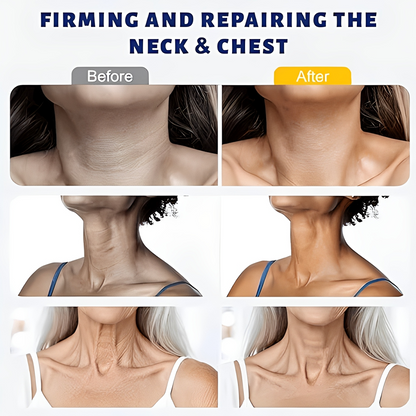 🎉 Purelora® Instant Neck Lifting Cream — 🍀 Enriched with Retinol and Hyaluronic Acid | Helps firm neck skin, reduce wrinkles, and improve the appearance of a double chin.