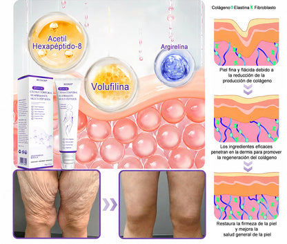 Funcionario de la FDA recomienda Hudros® PDRN: crema corporal con rodillo para antienvejecimiento, hidratación, reafirmación, lifting y reparación de la piel.También ayuda a mejorar manchas oscuras, acné, verrugas, lunares y síntomas de psoriasis.