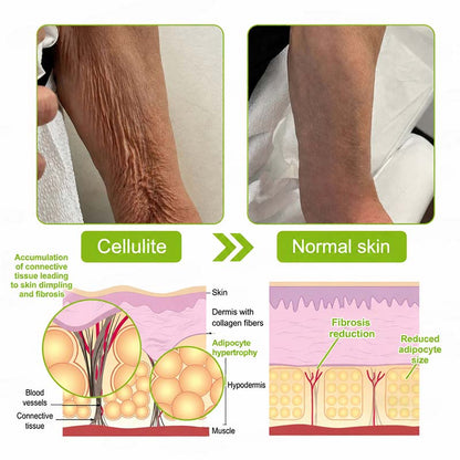 🇨🇦Purelora® Skin Tightening & Vita-A Retinol Retinol🍀 shot Firming anti-wrinkle cream - Last promotion with 70% discoun