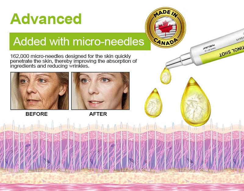 🇨🇦Purelora® Skin Tightening & Vita-A Retinol Retinol🍀 shot Firming anti-wrinkle cream - Last promotion with 70% discoun