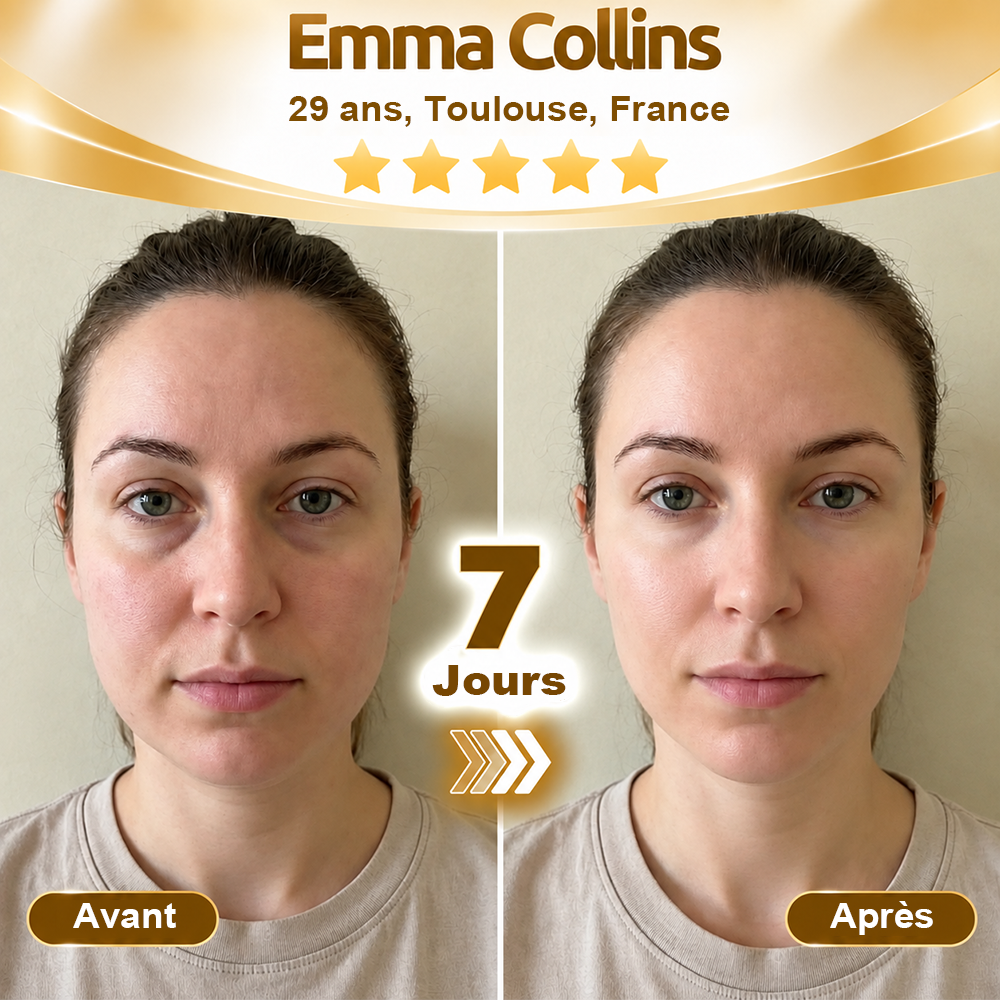 🔥 DERNIER JOUR : -80 % | Sérum antirides au venin de serpent – Lisse les ridules et raffermit visiblement la peau