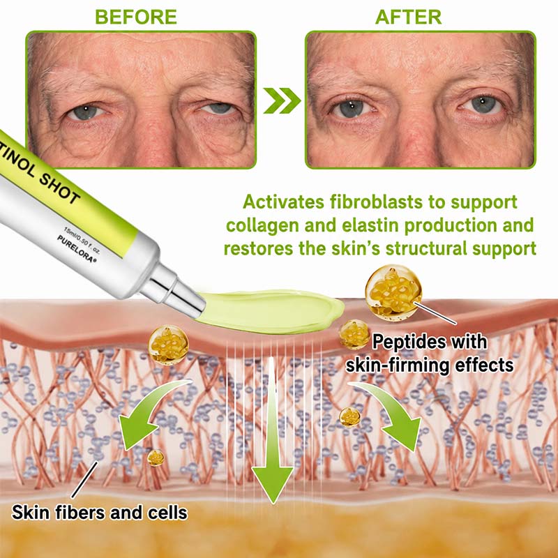 🇨🇦Purelora® Skin Tightening & Vita-A Retinol Retinol🍀 shot Firming anti-wrinkle cream - Last promotion with 70% discoun