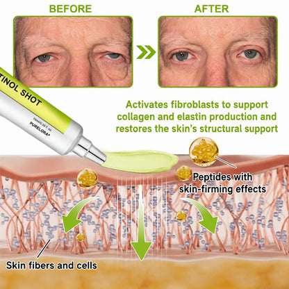 🇨🇦Purelora® Skin Tightening & Vita-A Retinol Retinol🍀 shot Firming anti-wrinkle cream - Last promotion with 70% discoun