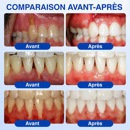 Purelora® 🧑‍⚕️ GumRevive Gel Réparateur Parodontal 🧸