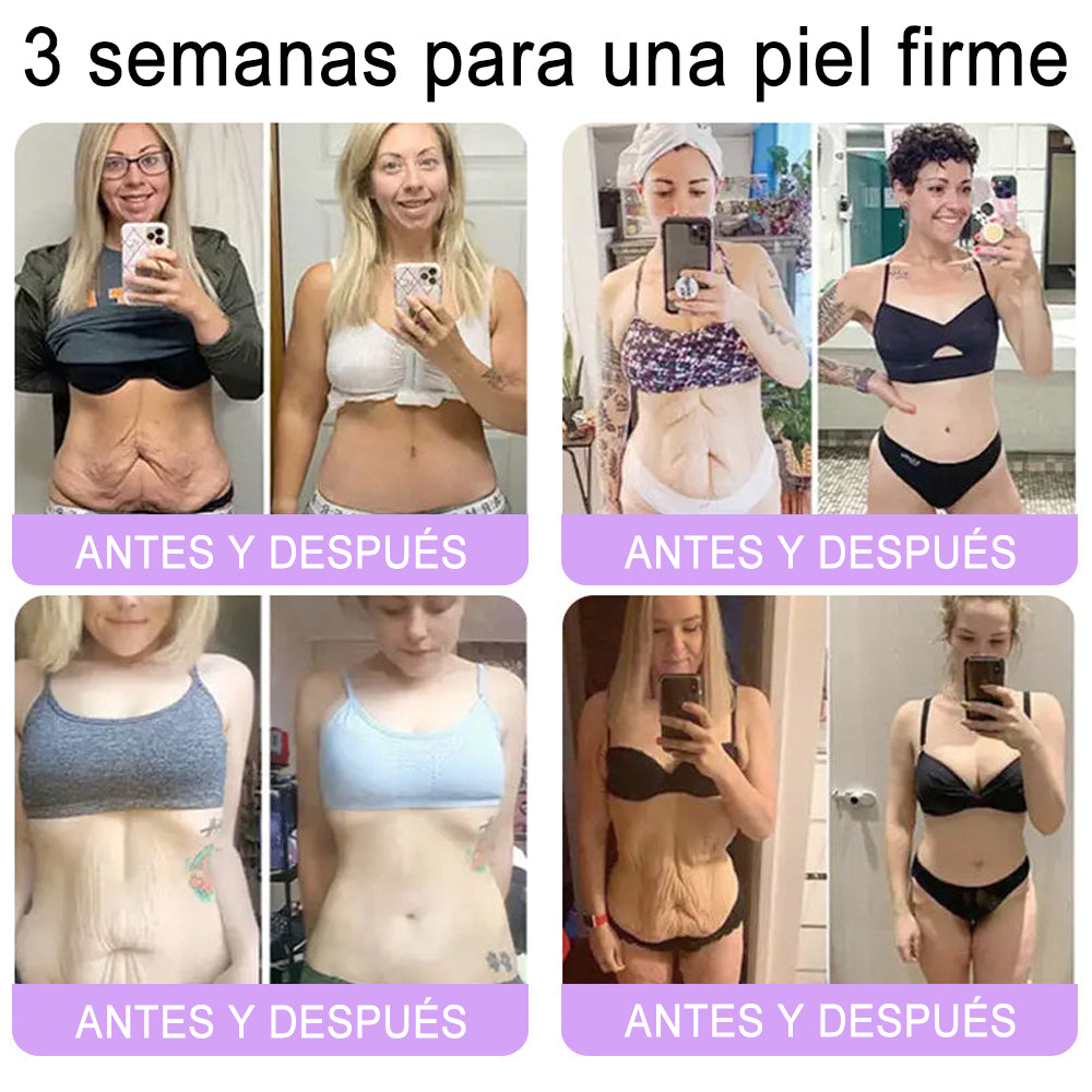 Funcionario de la FDA recomienda Hudros® PDRN: crema corporal con rodillo para antienvejecimiento, hidratación, reafirmación, lifting y reparación de la piel.También ayuda a mejorar manchas oscuras, acné, verrugas, lunares y síntomas de psoriasis.