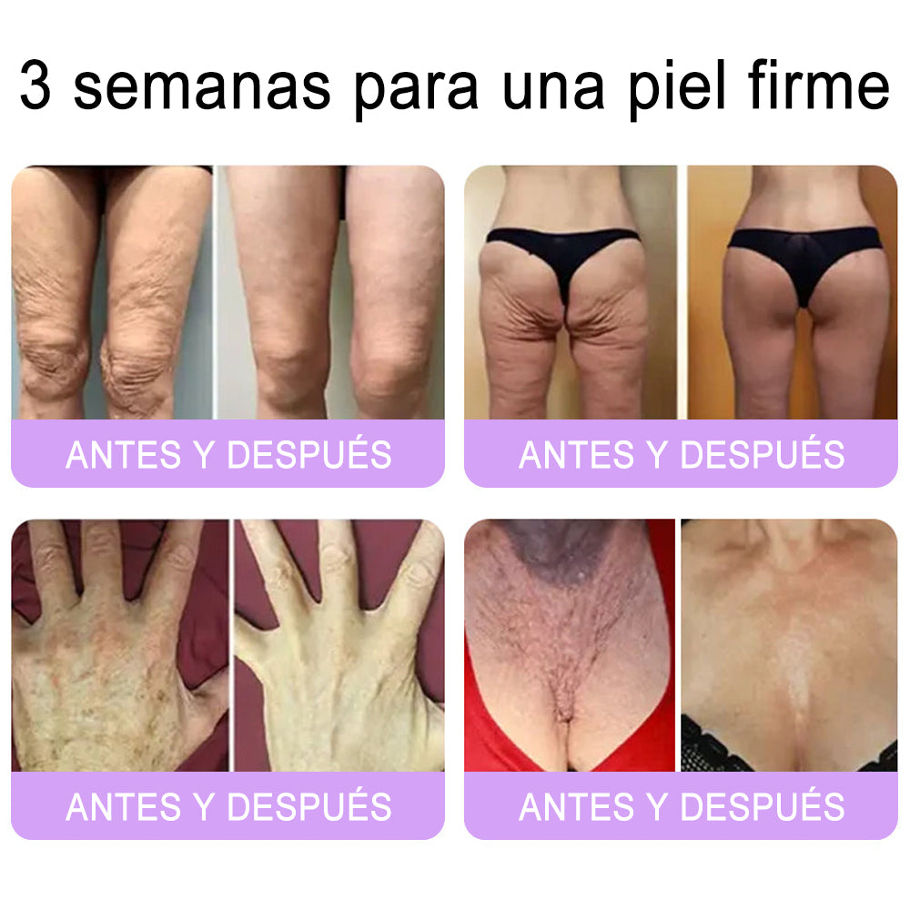 Funcionario de la FDA recomienda Hudros® PDRN: crema corporal con rodillo para antienvejecimiento, hidratación, reafirmación, lifting y reparación de la piel.También ayuda a mejorar manchas oscuras, acné, verrugas, lunares y síntomas de psoriasis.