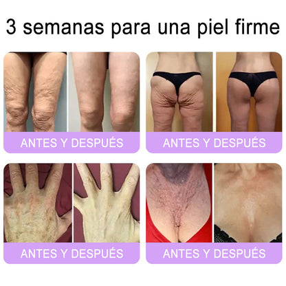 Funcionario de la FDA recomienda Hudros® PDRN: crema corporal con rodillo para antienvejecimiento, hidratación, reafirmación, lifting y reparación de la piel.También ayuda a mejorar manchas oscuras, acné, verrugas, lunares y síntomas de psoriasis.