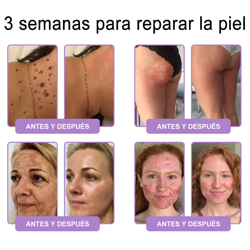 Funcionario de la FDA recomienda Hudros® PDRN: crema corporal con rodillo para antienvejecimiento, hidratación, reafirmación, lifting y reparación de la piel.También ayuda a mejorar manchas oscuras, acné, verrugas, lunares y síntomas de psoriasis.