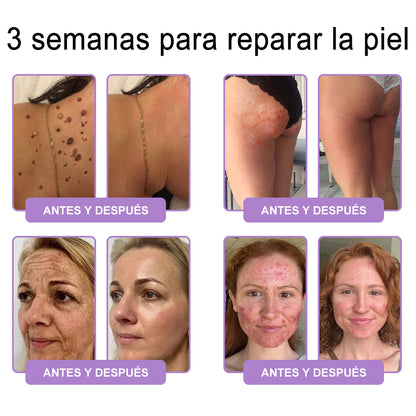 Funcionario de la FDA recomienda Hudros® PDRN: crema corporal con rodillo para antienvejecimiento, hidratación, reafirmación, lifting y reparación de la piel.También ayuda a mejorar manchas oscuras, acné, verrugas, lunares y síntomas de psoriasis.