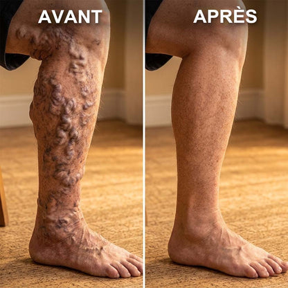 🔥 DERNIER JOUR : -80% | Semelles en Graphène Amincissantes | Soutien Minceur & Confort des Pieds