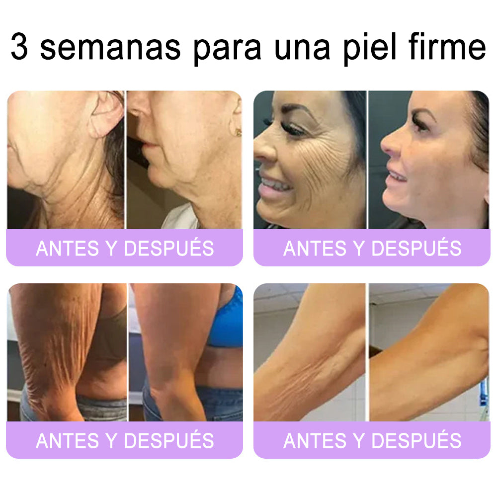 Funcionario de la FDA recomienda Hudros® PDRN: crema corporal con rodillo para antienvejecimiento, hidratación, reafirmación, lifting y reparación de la piel.También ayuda a mejorar manchas oscuras, acné, verrugas, lunares y síntomas de psoriasis.