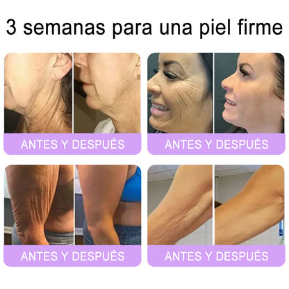 Funcionario de la FDA recomienda Hudros® PDRN: crema corporal con rodillo para antienvejecimiento, hidratación, reafirmación, lifting y reparación de la piel.También ayuda a mejorar manchas oscuras, acné, verrugas, lunares y síntomas de psoriasis.