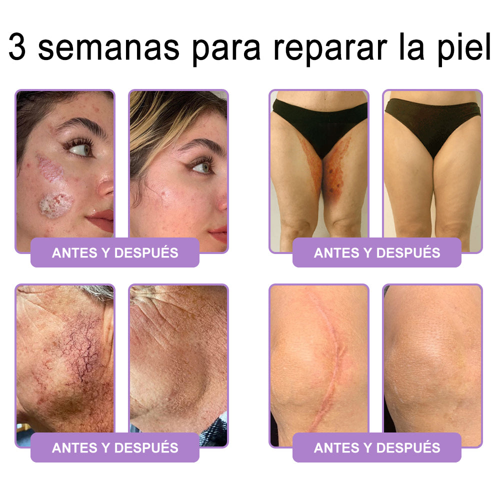 Funcionario de la FDA recomienda Hudros® PDRN: crema corporal con rodillo para antienvejecimiento, hidratación, reafirmación, lifting y reparación de la piel.También ayuda a mejorar manchas oscuras, acné, verrugas, lunares y síntomas de psoriasis.