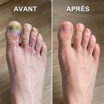 🔥 DERNIER JOUR : -80% | Semelles en Graphène Amincissantes | Soutien Minceur & Confort des Pieds