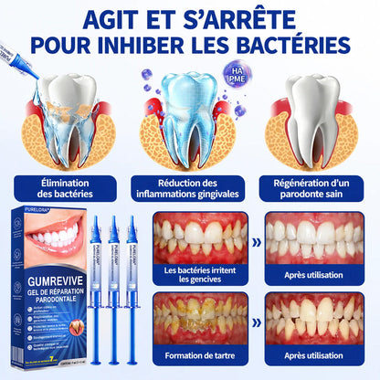 Purelora® 🧑‍⚕️ GumRevive Gel Réparateur Parodontal 🧸