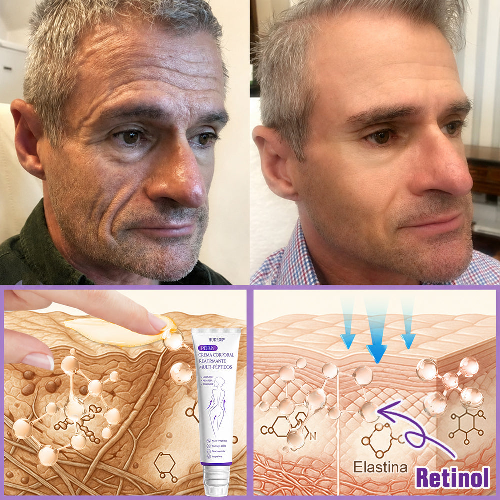 Funcionario de la FDA recomienda Hudros® PDRN: crema corporal con rodillo para antienvejecimiento, hidratación, reafirmación, lifting y reparación de la piel.También ayuda a mejorar manchas oscuras, acné, verrugas, lunares y síntomas de psoriasis.