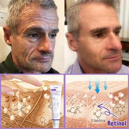 Funcionario de la FDA recomienda Hudros® PDRN: crema corporal con rodillo para antienvejecimiento, hidratación, reafirmación, lifting y reparación de la piel.También ayuda a mejorar manchas oscuras, acné, verrugas, lunares y síntomas de psoriasis.